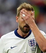 Image result for Harry Kane Teeth