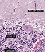 Image result for Brain Tissue Histology