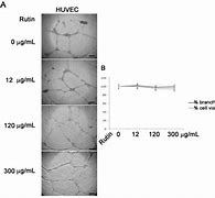 Image result for HUVEC Assay