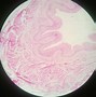 Image result for Ureter Blood Supply