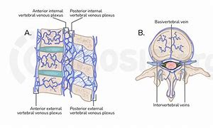 Image result for Venous Plexus Spine