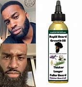 Image result for Gross Beard