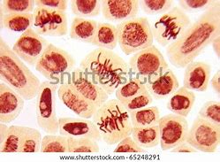 Image result for Dividing Cell and Non-Dividing Cells