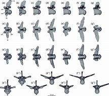 Image result for Dorsal Vertebrae