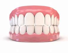 Image result for Ideal Bite Teeth