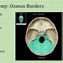 Image result for Extra-Axial Posterior Fossa Mass