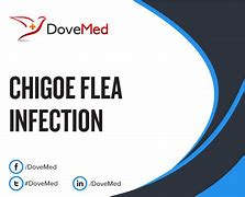 Image result for Chigoe Flea