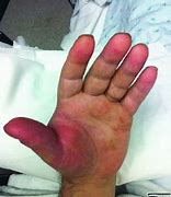 Image result for Cat Bite Girl Hand