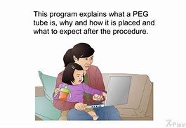 Image result for Peg Patient