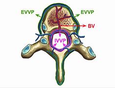 Image result for Venous Plexus Spine