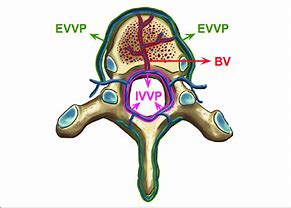 Image result for Vertebral Venous Plexus