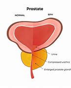 Image result for Prostate Gland Drawing