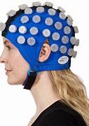 Image result for What Is a tDCS