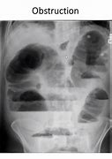 Image result for IRM Abdominal