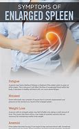 Image result for Spleen Disease Symptoms