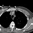 Image result for CT Scan Views