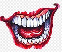 Image result for Joker Surgical Smile