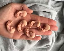 Image result for Embryo at 15 Weeks