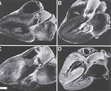 Image result for Anatomical Site of Left Ventricular Outflow Tract