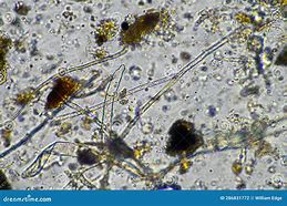 Image result for Fungal Hyphae in Soil