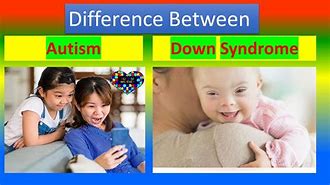 Image result for DownSyn Drome Autistic