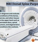 Image result for MRI Test