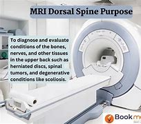 Image result for MRT Scan