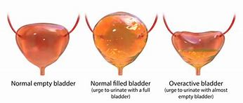 Image result for Normal Bladder