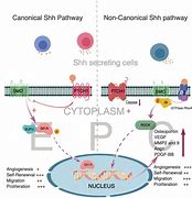 Image result for Shh Pathway Medulloblastoma