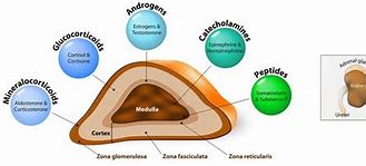 Image result for Adrenal Gland Adenoma