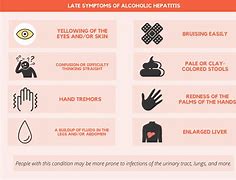 Image result for Alcoholic Symptoms in Men