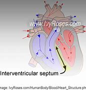 Image result for Interventricular Septum