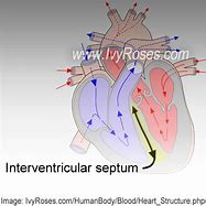 Image result for Myocardium of Interventricular Septum