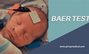 Image result for Baer in Heat