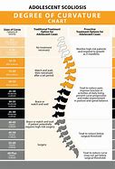 Image result for Degree of Curvature