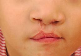 Image result for Kerb Lip