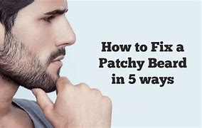 Image result for Getting Patches in My Beard