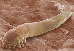 Image result for Mites Living On Face