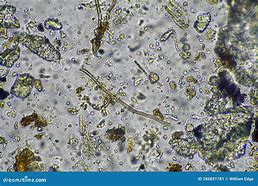 Image result for Fungal Hyphae in Soil