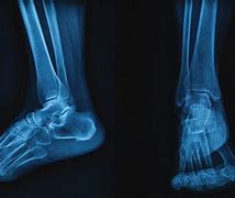 Image result for Medical Foot Anatomy