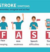 Image result for Stroke Cure