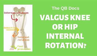 Image result for Lateral Knee Internal vs External Rotation