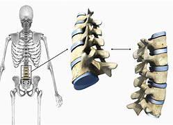 Image result for Examples of Cartilaginous Joints