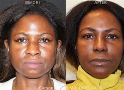 Image result for African American Nose vs African Nose