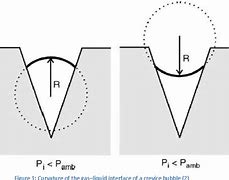 Image result for Arterial Emboli