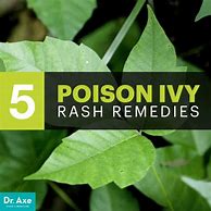 Image result for Poison Ivy Remedy