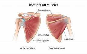 Image result for Supraspinatus and Infraspinatus Tendinopathy