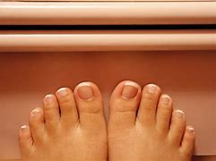 Image result for Keratin Debris Toenails