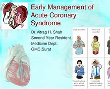 Image result for ACS Management