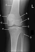 Image result for PA Oblique Lateral Rotation Knee